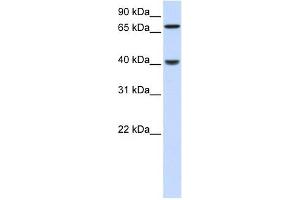 PDLIM3 antibody used at 1 ug/ml to detect target protein. (PDLIM3 antibody  (N-Term))