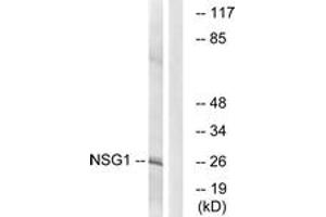 Western blot analysis of extracts from COLO cells, using NSG1 Antibody. (NSG1 antibody  (AA 112-161))