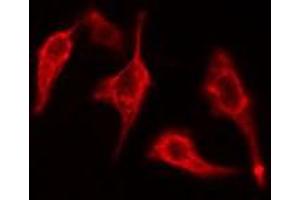 ABIN6275435 staining 293 cells by IF/ICC. (RAB3GAP1 antibody  (Internal Region))