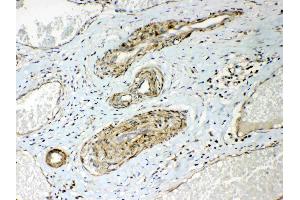 IHC analysis of HSPB8/Hsp22 using anti- HSPB8/Hsp22 antibody .