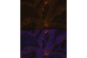 Immunofluorescence analysis of human colon carcinoma using TFF1/pS2 Rabbit mAb (ABIN7270972) at dilution of 1:100 (40x lens). (TFF1 antibody  (pSer2))