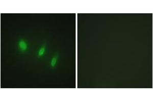 Immunofluorescence analysis of HeLa cells, using FOXO4 (Ab-451) Antibody. (FOXO4 antibody  (AA 417-466))