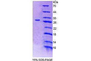 Image no. 1 for Transporter 2, ATP-Binding Cassette, Sub-Family B (MDR/TAP) (TAP2) (AA 468-686) protein (His tag) (ABIN4989728) (TAP2 Protein (AA 468-686) (His tag))