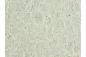 Immunohistochemistry of paraffin-embedded human heart tissue using ABIN7176171 at dilution of 1:100 (ZNF226 antibody  (AA 1-94))