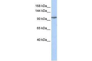 Western Blotting (WB) image for anti-Glutamate Receptor, Ionotropic, Kainate 5 (GRIK5) antibody (ABIN2458266) (GRIK5 antibody)