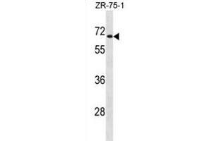 UGT2B28 Antibody (Center) (ABIN1881976 and ABIN2838847) western blot analysis in ZR-75-1 cell line lysates (35 μg/lane). (UGT2B28 antibody  (AA 218-246))