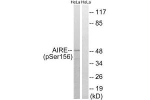 Western Blotting (WB) image for anti-Autoimmune Regulator (AIRE) (pSer156) antibody (ABIN1847730) (AIRE antibody  (pSer156))