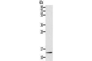 Gel: 12 % SDS-PAGE, Lysate: 40 μg, Lane: Mouse liver tissue, Primary antibody: ABIN7130906(RNF7 Antibody) at dilution 1/250, Secondary antibody: Goat anti rabbit IgG at 1/8000 dilution, Exposure time: 10 minutes (RNF7 antibody)