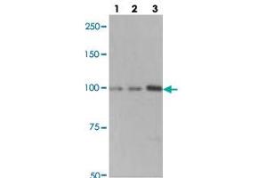 Western blot analysis of lane 1: A549 cell lysate, lane 2: H460 cell lysate and lane 3: H1703 cell lysate using MARS polyclonal antibody . (Mars (MARS) antibody)