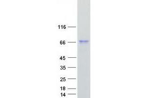 Western Blotting (WB) image for Intestinal Alkaline Phosphatase (ALPI) protein (Myc-DYKDDDDK Tag) (ABIN2714569)