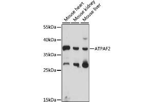 Western blot analysis of extracts of various cell lines, using  antibody (ABIN7265717) at 1000 dilution. (ATPAF2 antibody  (AA 41-200))