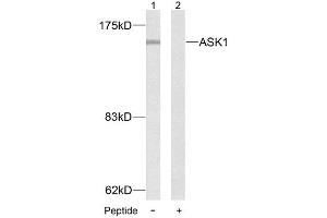 Western blot analysis of extract from MDA-MB- 435 cells, using ASK1 (Ab-83) antibody (E021125). (ASK1 antibody)