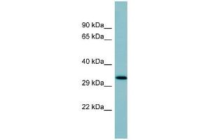 SFTPD antibody used at 1 ug/ml to detect target protein. (SFTPD antibody  (Middle Region))