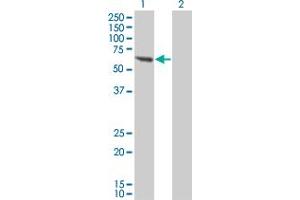 Western Blotting (WB) image for anti-Protein Phosphatase, Mg2+/Mn2+ Dependent, 1B (PPM1B) (AA 1-192) antibody (ABIN562341)