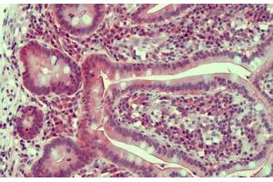 Human Small Intestine: Formalin-Fixed, Paraffin-Embedded (FFPE) (Claudin 2 antibody  (AA 135-164))