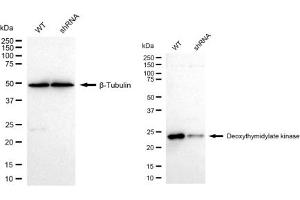 Western blotting analysis using Deoxythymidylate kinase antibody (ABIN7798311).