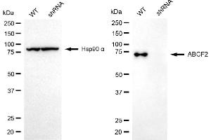 Western blotting analysis using ABCF2 antibody (ABIN7797689).