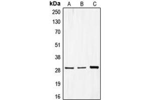 Western blot analysis of CDCA3 expression in MCF7 (A), Caco2 (B), HepG2 (C) whole cell lysates. (CDCA3 antibody  (C-Term))