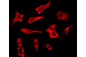 ABIN6276224 staining COLO205 by IF/ICC. (TAS2R19 antibody  (Internal Region))