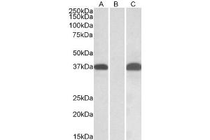Western Blotting (WB) image for anti-Proto-Oncogene Pim-2 (Serine Threonine Kinase) (PIM2) (AA 23-36) antibody (ABIN5904200) (PIM2 antibody  (AA 23-36))