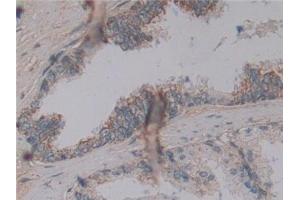 Immunohistochemistry (IHC) image for anti-Microfibrillar Associated Protein 2 (MFAP2) (AA 6-162) antibody (ABIN7442855)