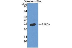 Western Blotting (WB) image for anti-Apoptosis-Associated tyrosine Kinase (AATK) (AA 1216-1374) antibody (ABIN2117008) (AATK antibody  (AA 1216-1374))