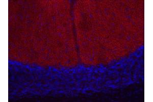 Indirect immunostaining of PFA fixed mouse cerebellum section (dilution 1 : 200; red). (CACNA1B antibody)