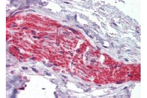 Nerve, Human: Formalin-Fixed, Paraffin-Embedded (FFPE) (Ankyrin G antibody)