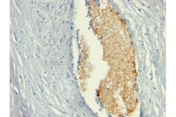 AMPD3 antibody