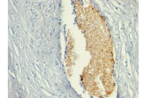 Formalin-fixed, paraffin-embedded human Placenta stained with AMPD3 Mouse Monoclonal Antibody (AMPD3/901) (AMPD3 antibody)