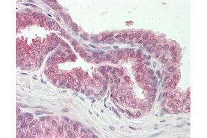 Human Prostate: Formalin-Fixed, Paraffin-Embedded (FFPE). (SMARCD2 antibody  (AA 440-489))