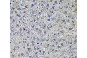 Immunohistochemistry (Paraffin-embedded Sections) (IHC (p)) image for anti-Small Nuclear Ribonucleoprotein Polypeptide A (SNRPA) antibody (ABIN7262230)