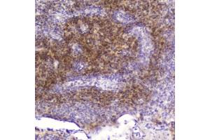 IHC testing of FFPE human tonsil tissue with FABP3 antibody at 2ug/ml.