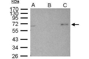 IP Image AMPK alpha 2 antibody immunoprecipitates AMPK alpha 2 protein in IP experiments. (PRKAA2 antibody  (Center))