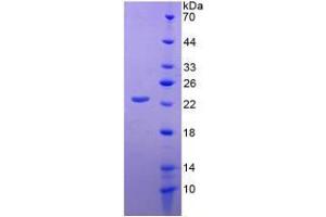 Image no. 1 for CD276 (CD276) (AA 47-219) (Active) protein (His tag) (ABIN5665775) (CD276 Protein (CD276) (AA 47-219) (His tag))