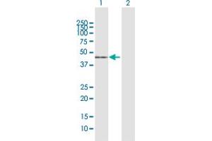 Western Blot analysis of ACADM expression in transfected 293T cell line by ACADM MaxPab polyclonal antibody. (Medium-Chain Specific Acyl-CoA Dehydrogenase, Mitochondrial (MCAD) (AA 1-421) antibody)