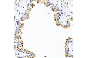 Immunohistochemistry of paraffin-embedded mouse lung using COL10A1 antibody (ABIN5974149) at dilution of 1/100 (40x lens). (COL10A1 antibody)