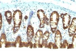 Immunohistochemistry (IHC) image for anti-Epithelial Cell Adhesion Molecule (EPCAM) (Cytoplasmic Domain) antibody (ABIN3024723)