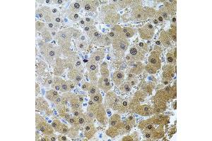 Immunohistochemistry of paraffin-embedded human liver damage using RNF166 antibody (ABIN6135036, ABIN6147021, ABIN6147024 and ABIN6224290) (40x lens). (RNF166 antibody  (C-Term))