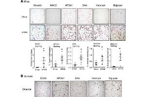 Immunohistochemistry (IHC) image for anti-Apolipoprotein A-I (APOA1) antibody (ABIN5596808)