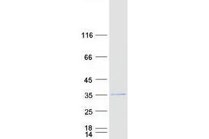 Williams-Beuren Syndrome Chromosome Region 28 (WBSCR28) protein (Myc-DYKDDDDK Tag)