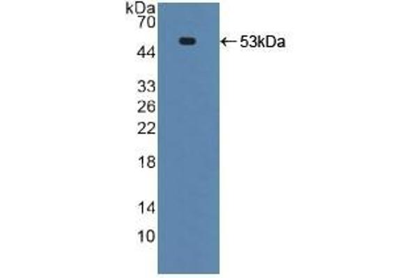 TNFRSF10B antibody  (AA 234-435)