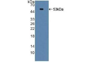 Detection of Recombinant TNFRSF10B, Human using Polyclonal Antibody to Death receptor 5 (DR5) (TNFRSF10B antibody  (AA 234-435))