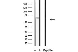anti-Ceramide Kinase-Like (CERKL) (Internal Region) antibody