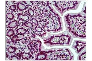 Human Small Intestine: Formalin-Fixed, Paraffin-Embedded (FFPE) (SMARCA4 antibody  (N-Term))