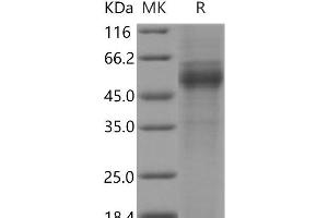 Western Blotting (WB) image for Collectin Sub-Family Member 10 (C-Type Lectin) (COLEC10) protein (Fc Tag) (ABIN7320377) (COLEC10 Protein (Fc Tag))