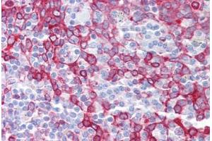 Anti-OGFOD1 antibody IHC staining of human tonsil. (OGFOD1 antibody  (C-Term))
