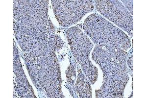 IHC analysis of ACLY using anti-ACLY antibody (ABIN4886416).