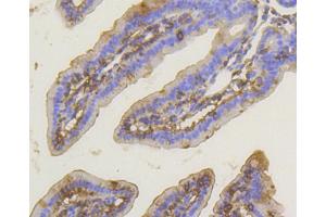 Immunohistochemistry of paraffin-embedded mouse intestin using PRKCA antibody (ABIN5997085) at dilution of 1/100 (40x lens).