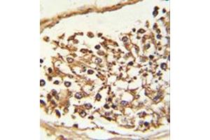 Formalin-fixed and paraffin-embedded human Testis tissue reacted with JMJD2B Antibody (N-term) followed which was peroxidase-conjugated to the secondary antibody, followed by DAB staining. (KDM4B antibody  (N-Term))